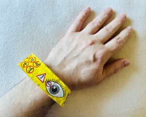 Stewart’s left wrist with a yellow ‘warning’ band for gas in the eye.