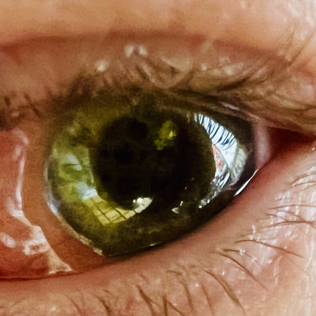 Extreme close-up of my left eye, with green iris and reddening of the sclera.